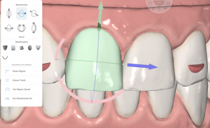 pindas Shilling distillatie ORTHO MET HIGH TECH DIGITALE COMPUTERSIMULATIES. – FRIENDS4DENTS